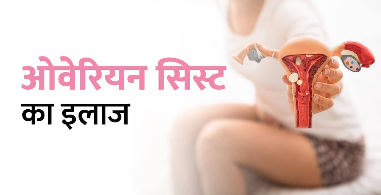 ओवरी में गांठ का घरेलू इलाज &#8211; Ovarian Cyst Treatment in Hindi
