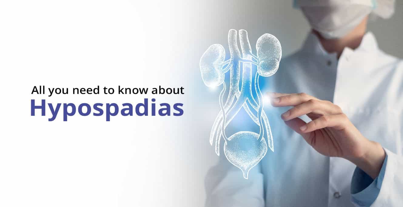 Hypospadias কি? – কারণ ও লক্ষণ