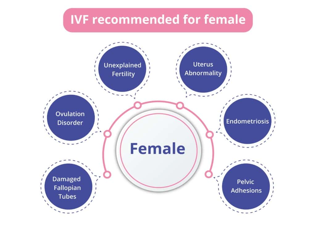IVF (In Vitro Fertilization): Procedure, Treatment, Do's & Don'ts