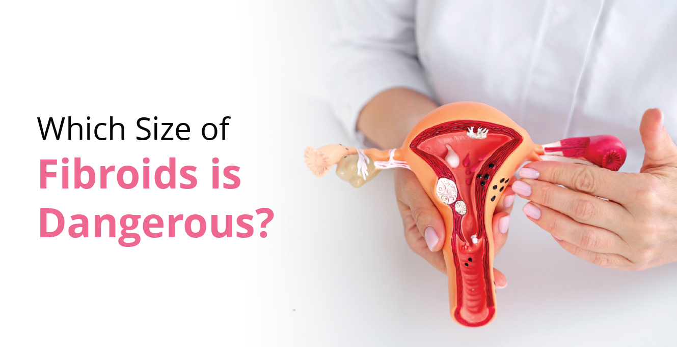 Which Size of Fibroids is Dangerous?