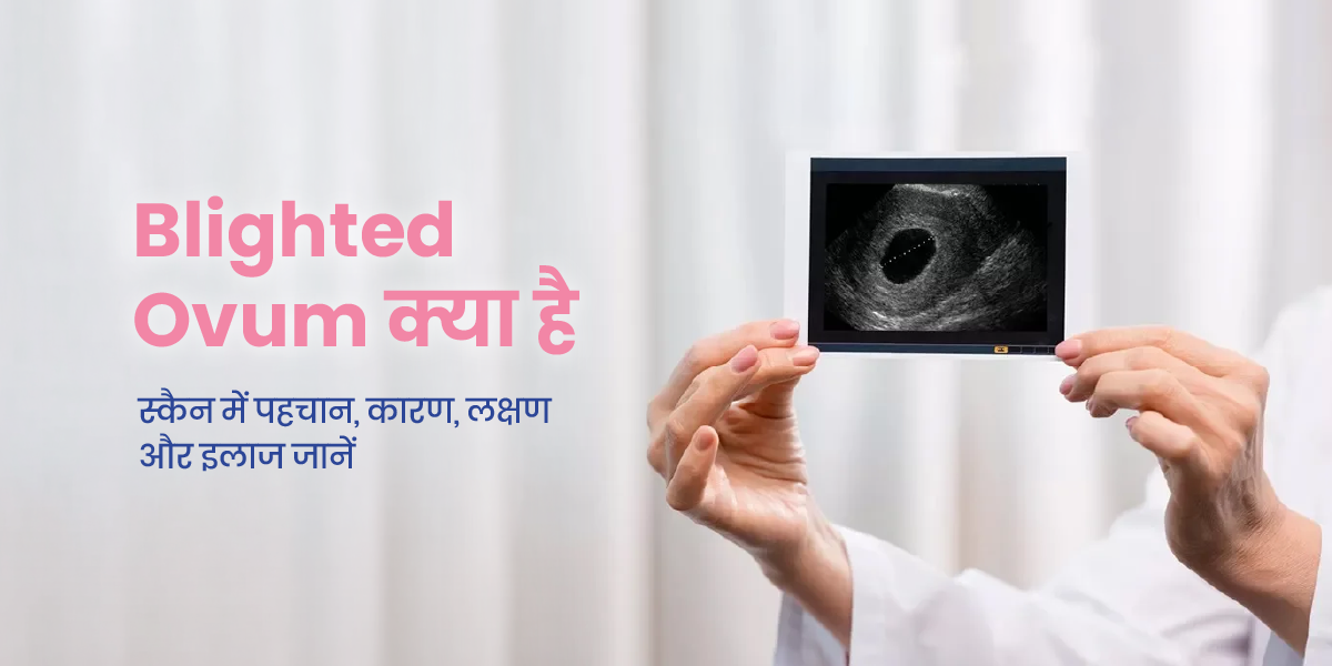 ब्लाइटेड ओवम (Blighted Ovum) क्या है? कारण, लक्षण और उपचार